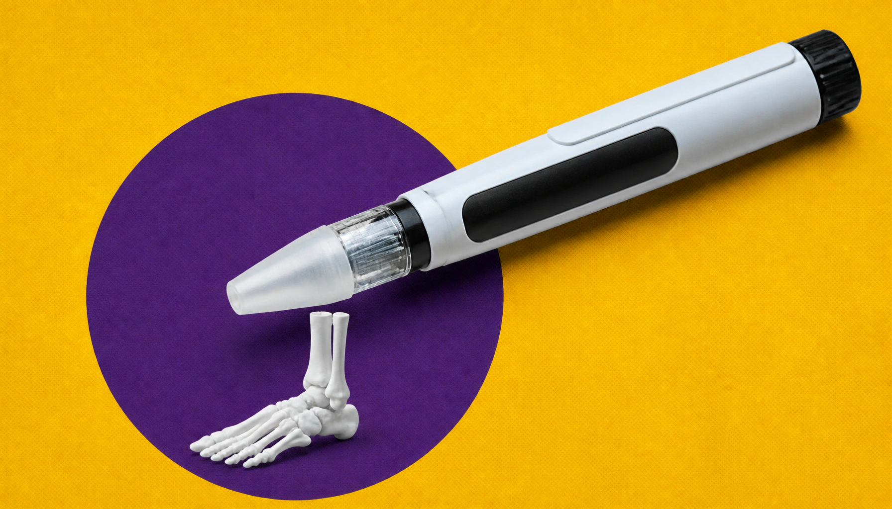 GLP-1s show major promise for patients with peripheral artery disease and diabetes