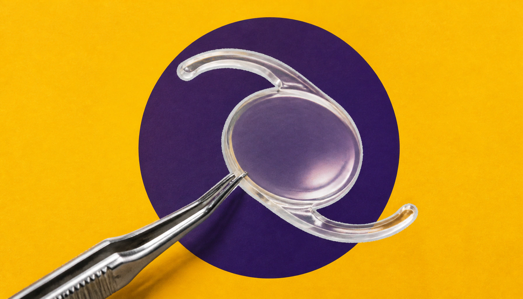 Alcon and RxSight team up to create a first-of-its-kind tunable cataract lens