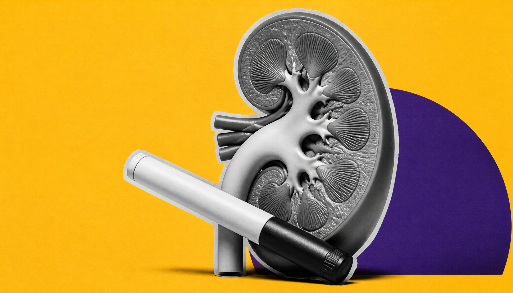 Nephrologists urged to embrace SGLT2 and GLP-1 therapies to close the CKM care gap