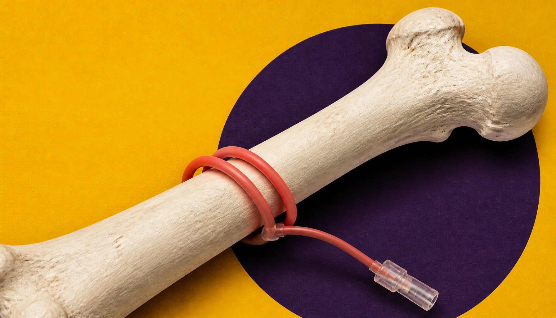 Landmark genomic map uncovers hundreds of new bone health genes