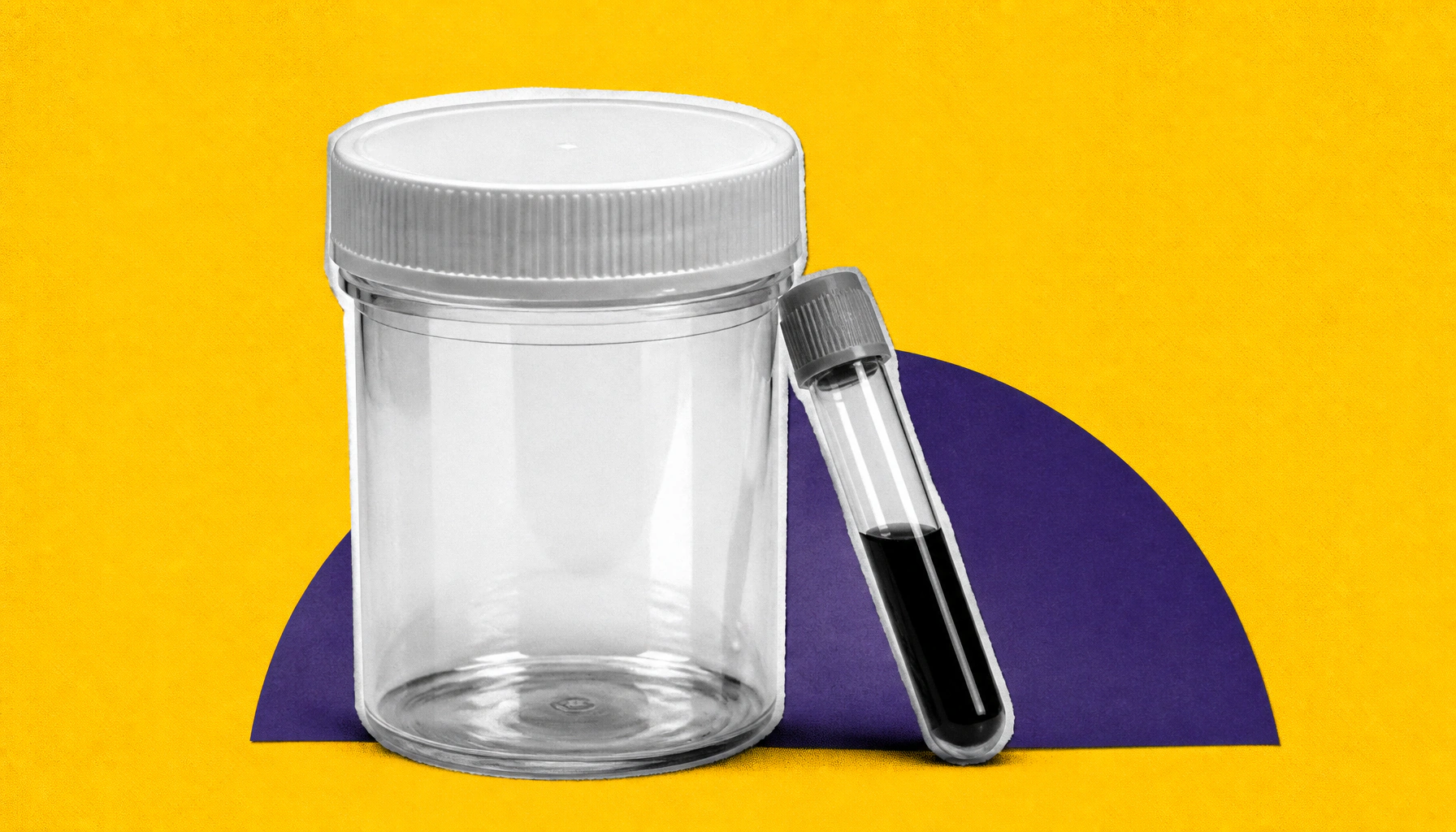 pCR beats ctDNA clearance as a prognostic marker in solid tumor immunotherapy trials