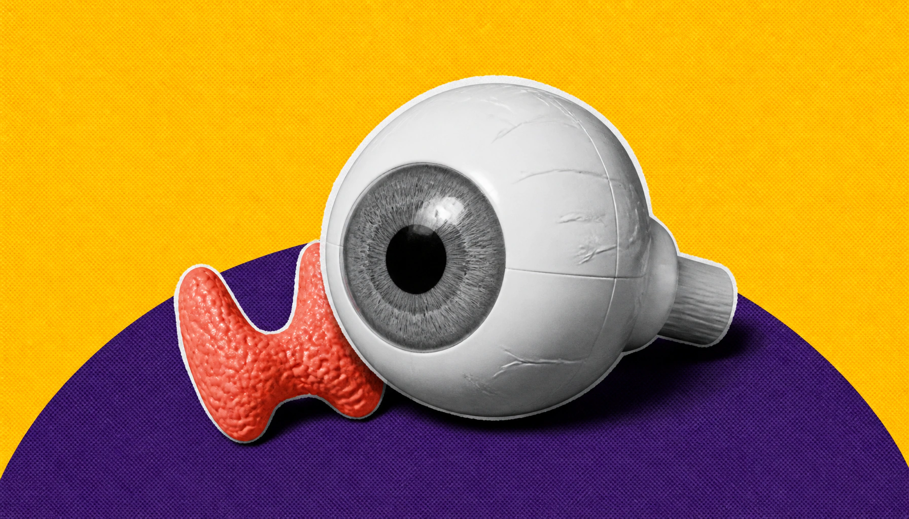 Euthyroid thyroid eye disease: a tricky diagnosis hiding in plain sight