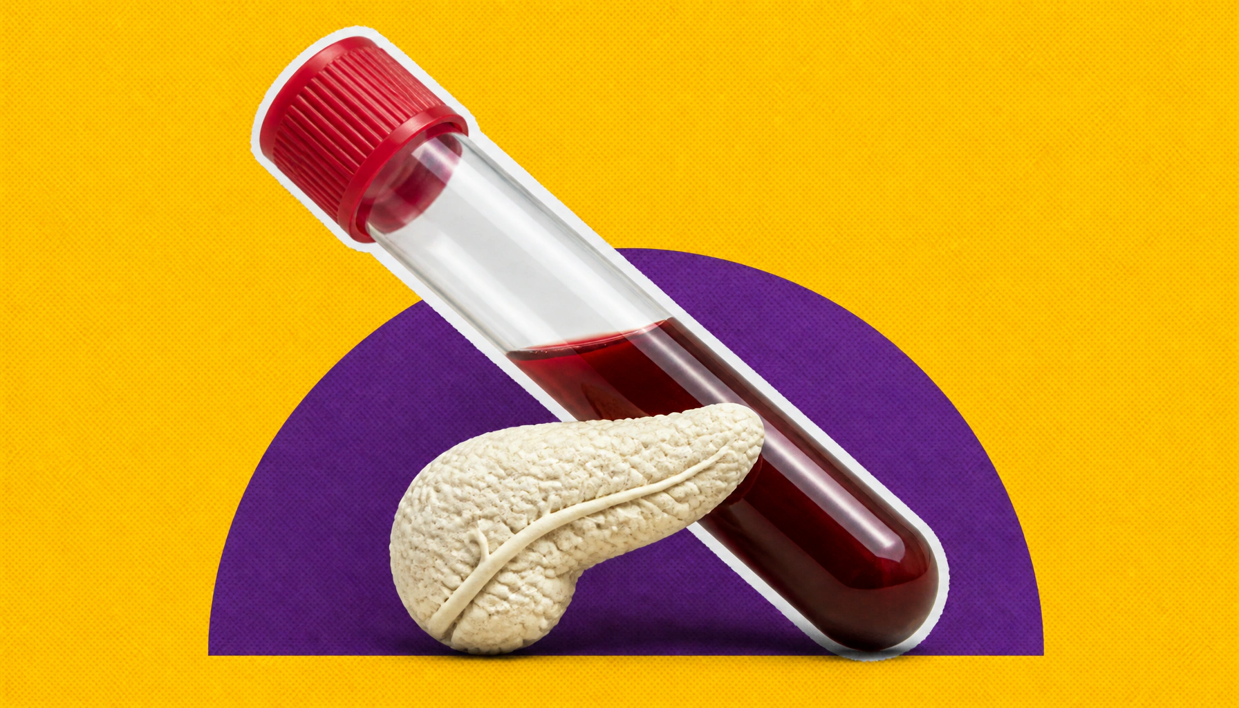 A more sensitive ctDNA test may transform how we detect and manage pancreatic cancer