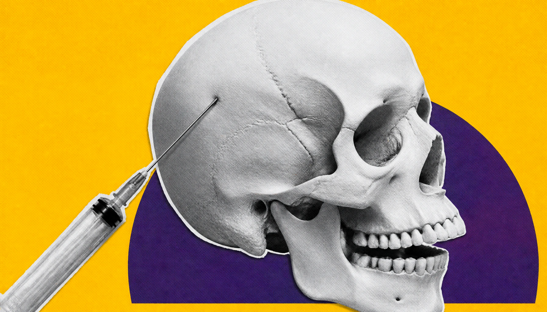 NIH backs skull-embedded implant to deliver drugs directly to brain tumors
