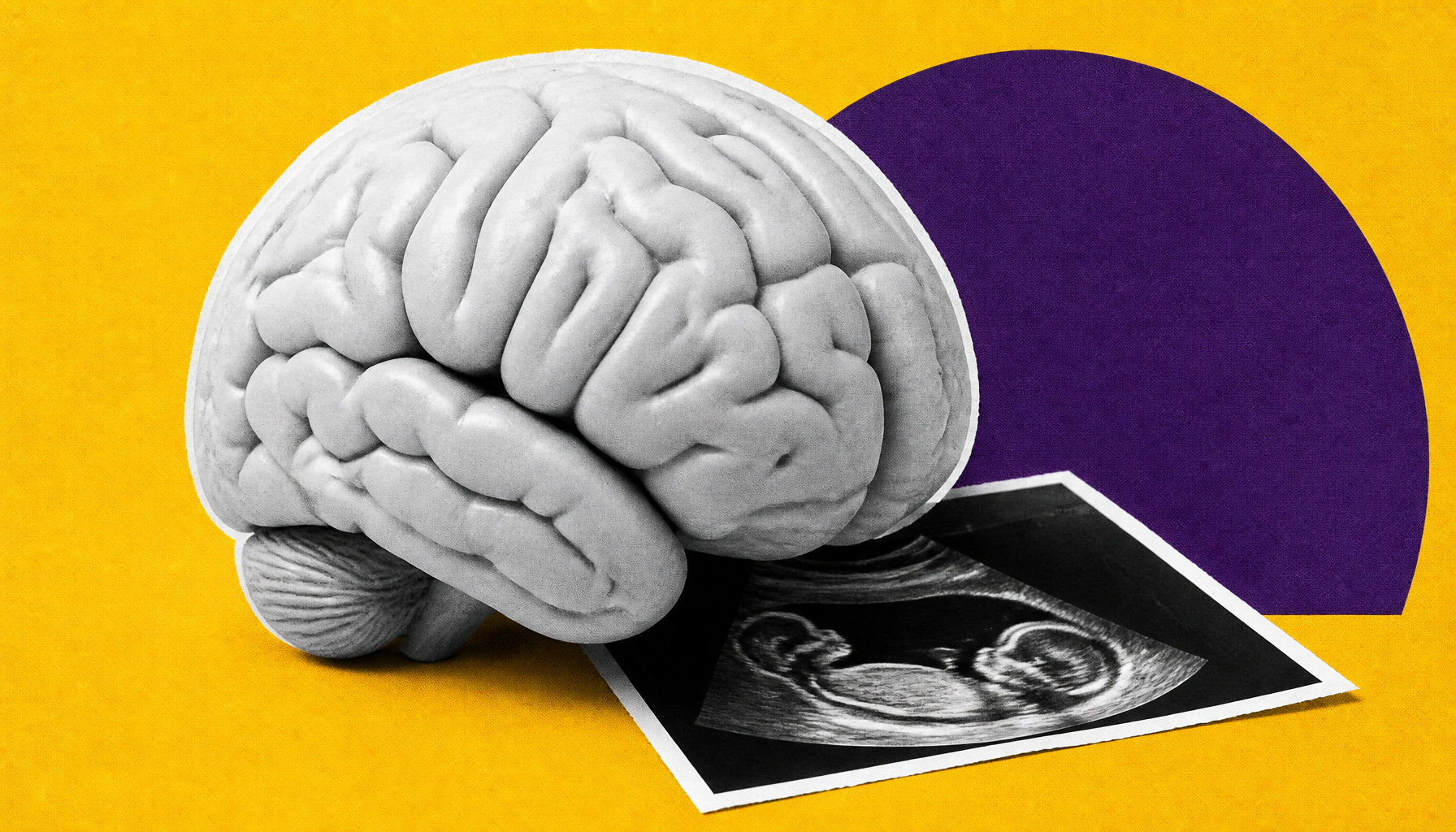 Every pregnancy rewires the brain differently — and that matters for maternal mental health