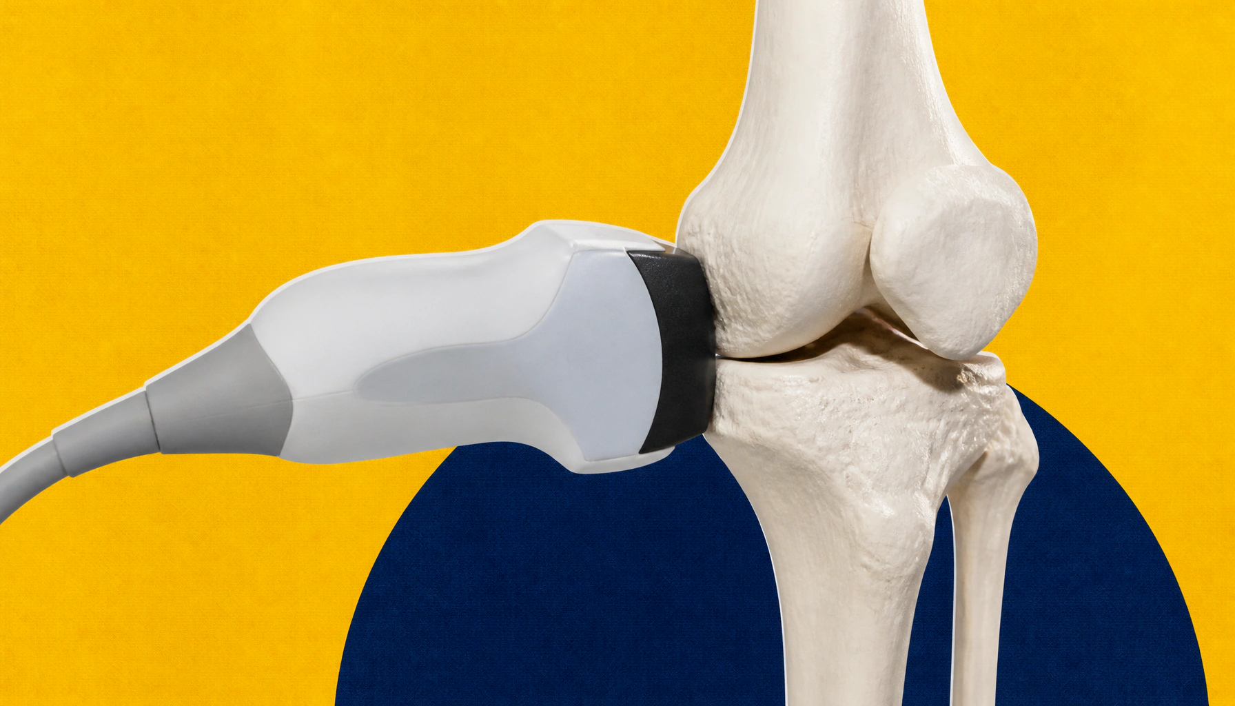 Ultrasound therapy could short-circuit the path to arthritis by retraining immune cells