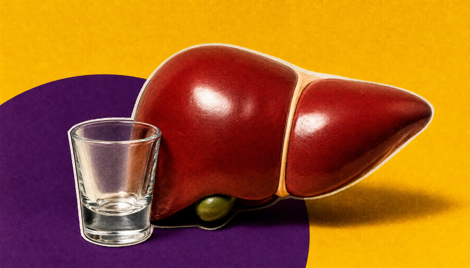 Lean MetALD carries higher mortality risk than its heavier counterpart
