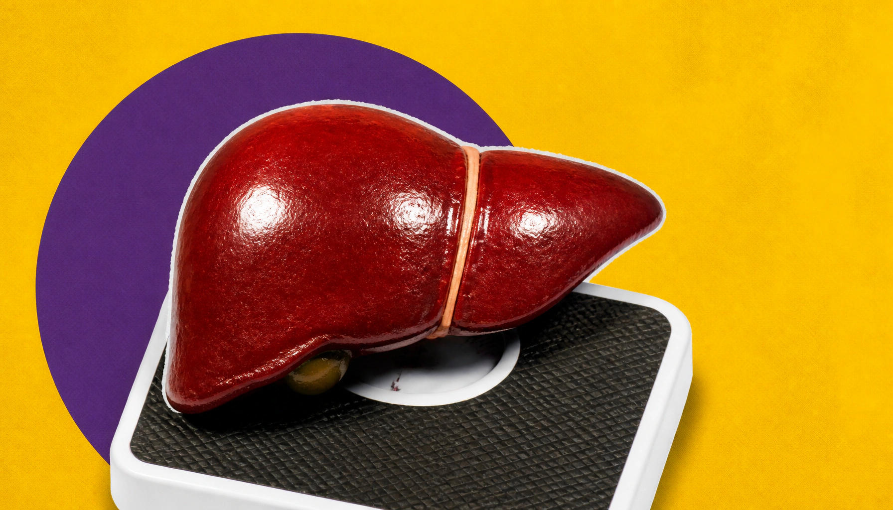 It's not the diet — it's the weight loss and cutting ultra-processed foods that help MASLD