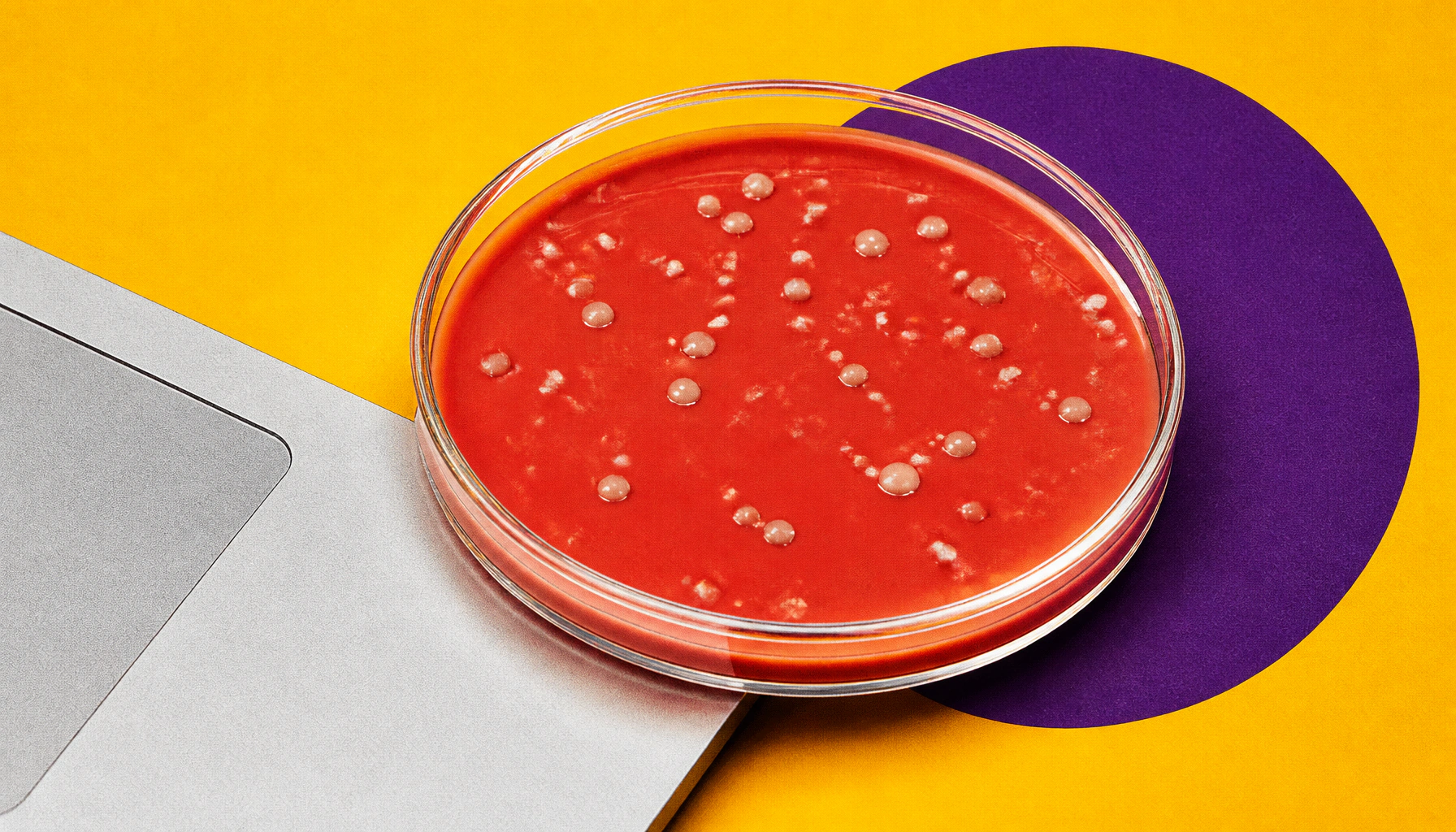 AI is helping crack one of medicine's oldest cold cases: tuberculosis