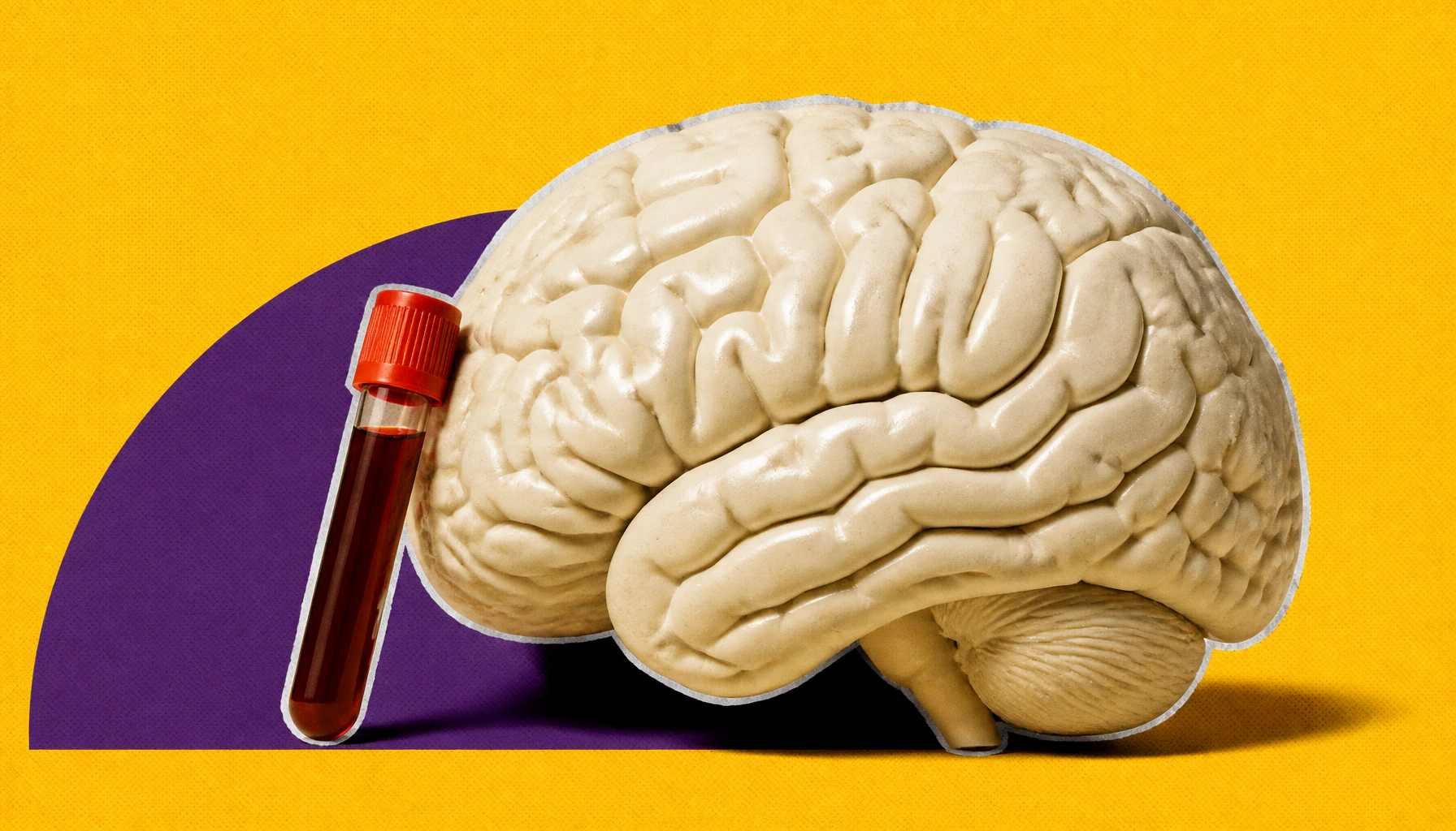 New guidelines aim to standardize cognitive screening for sickle cell disease patients