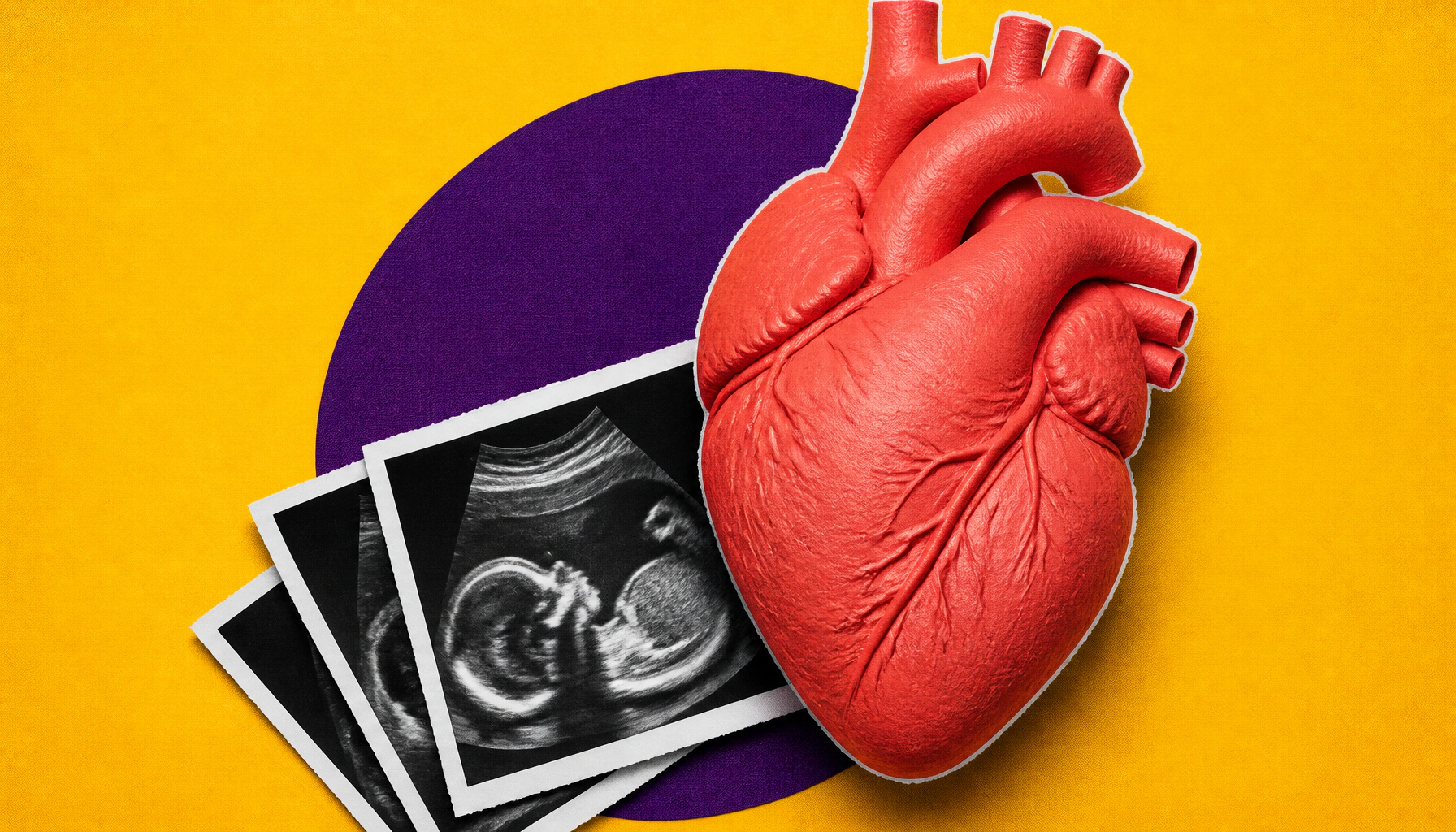 Pregnancy complications and CVD death risk: it's not one-size-fits-all