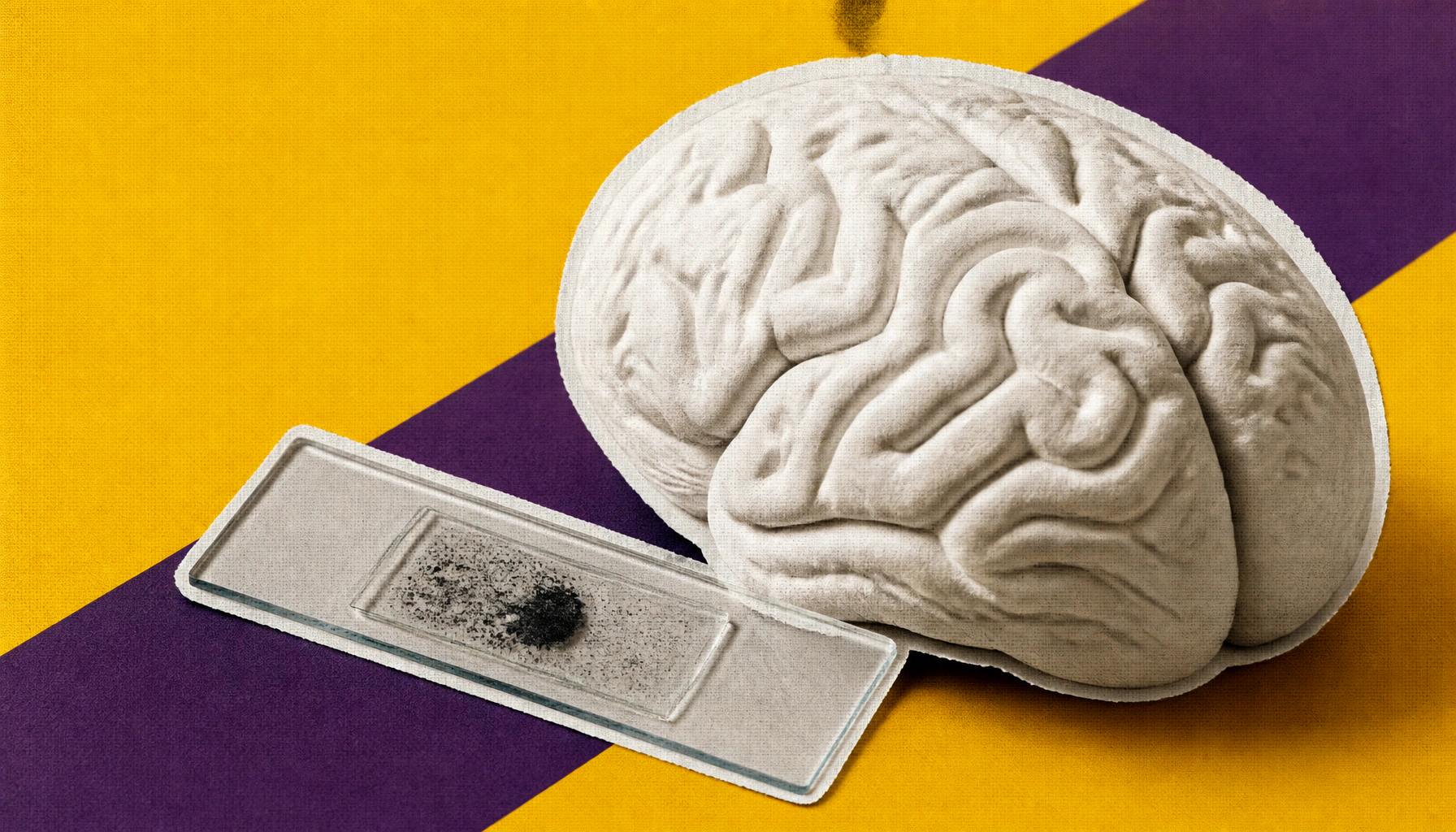 Scientists map brain immune cells in unprecedented detail, revealing a new path to fight Alzheimer's