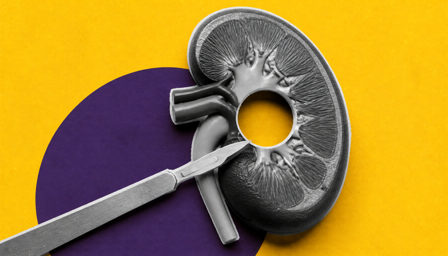 Kidney-sparing surgery showdown: Tumor enucleation edges out partial nephrectomy on function and safety