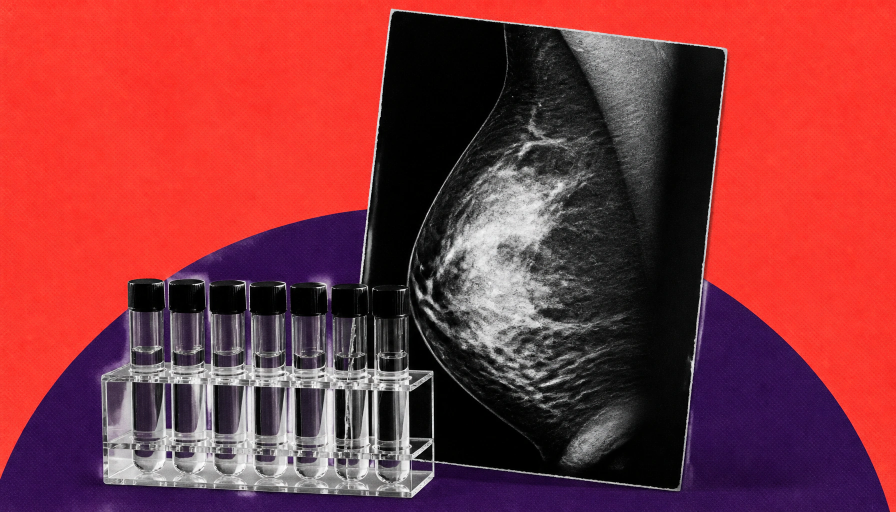 Breast cancer is rising fast in Asian American women — and experts are alarmed