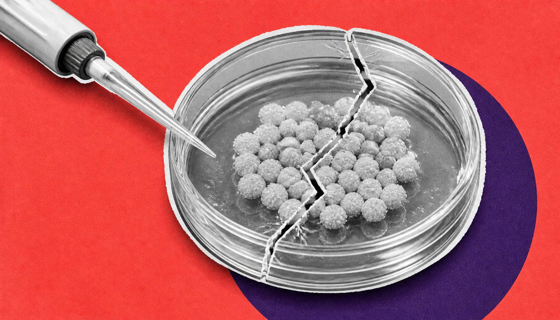 CRISPR gene editing alone isn't enough to shield beta-cell transplants from immune rejection