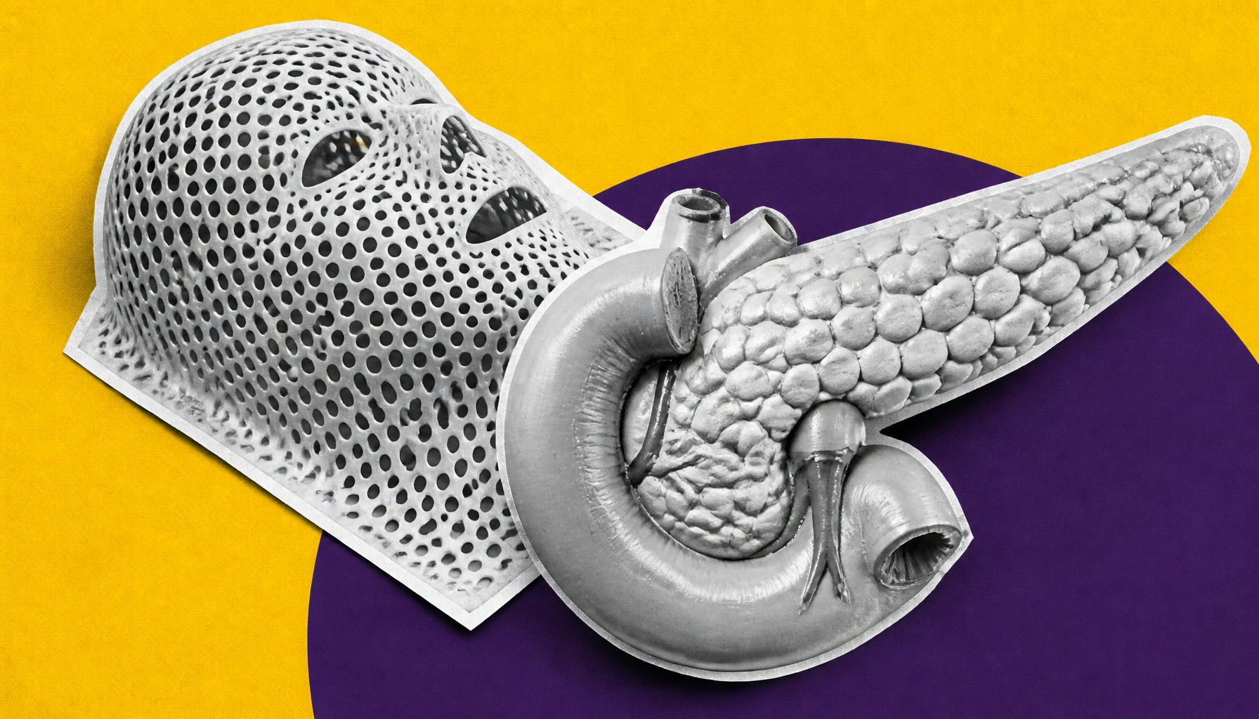 ASTRO's updated radiation therapy guidelines bring new hope for pancreatic cancer treatment