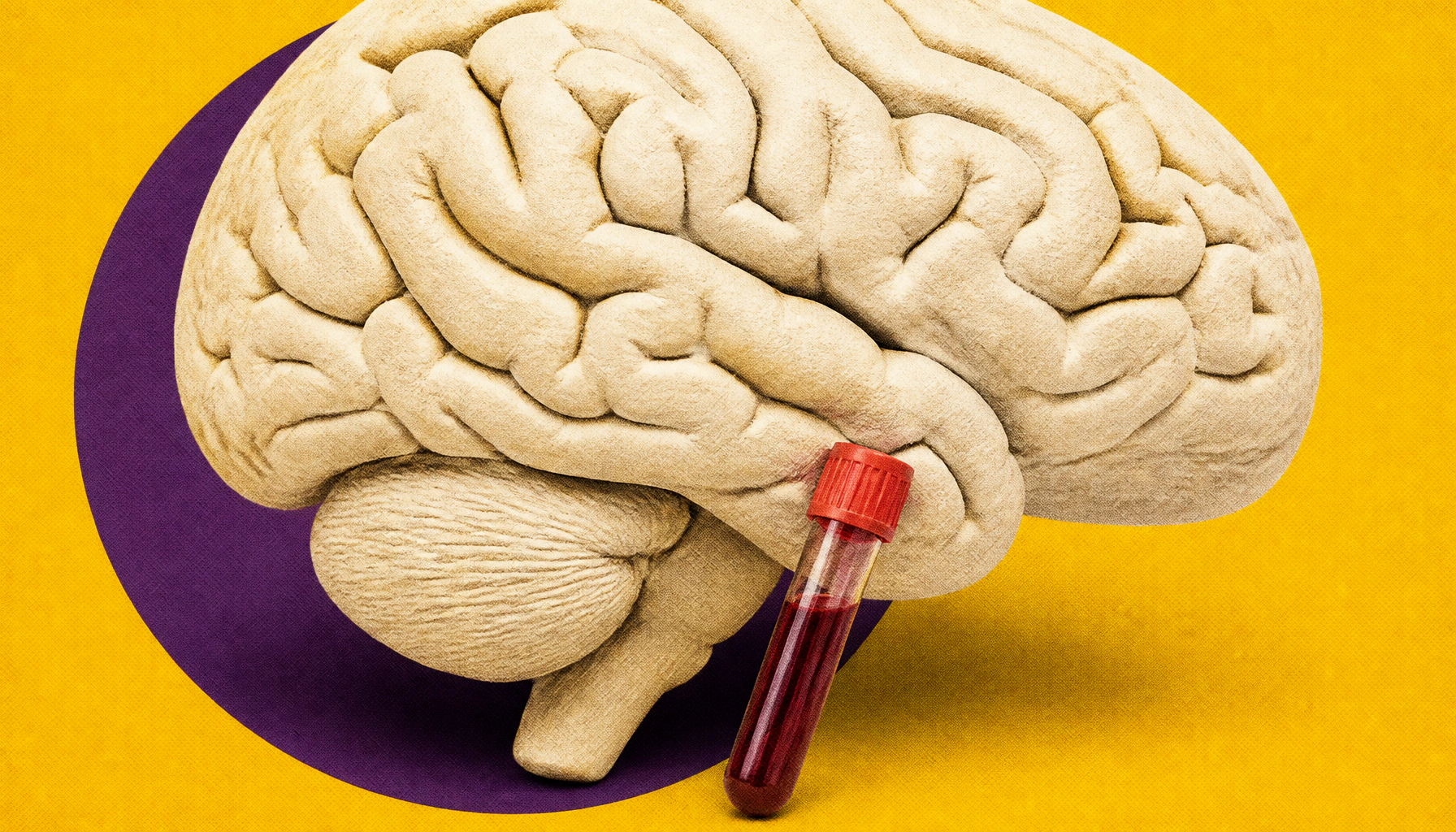 Blood tests alone may miss HIV activity in the brains of teens