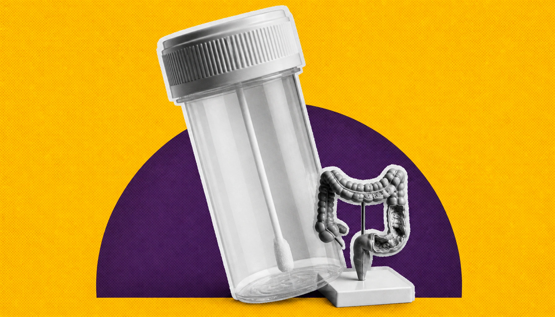 A simple at-home stool test slashes colorectal cancer death risk by 43%