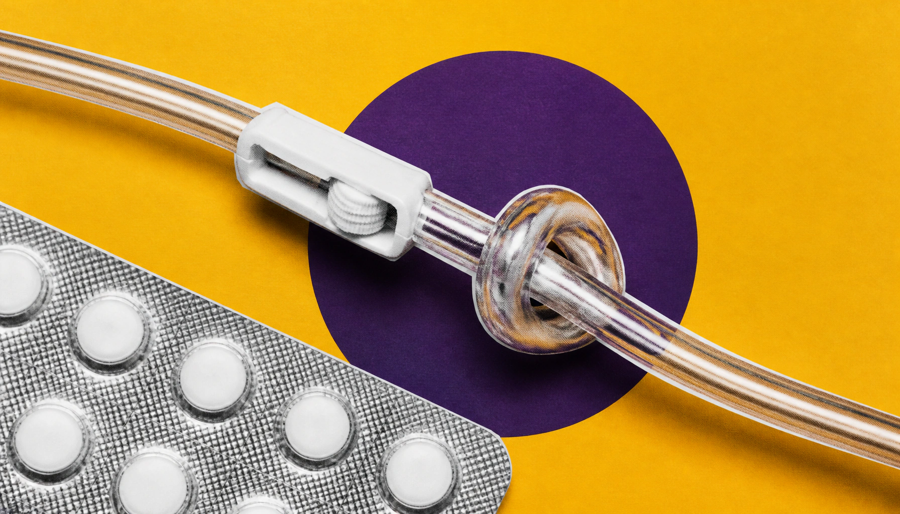 A molecular "off switch" could unlock new treatment options for triple-negative breast cancer