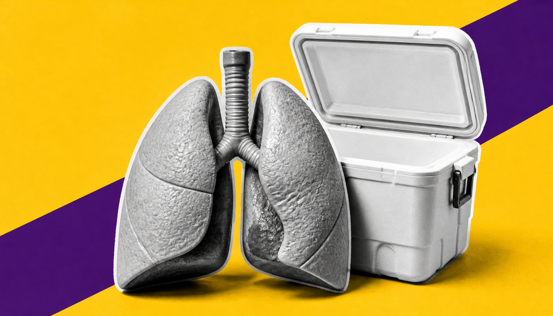 Lung transplant offers a lifeline for select stage IV NSCLC patients