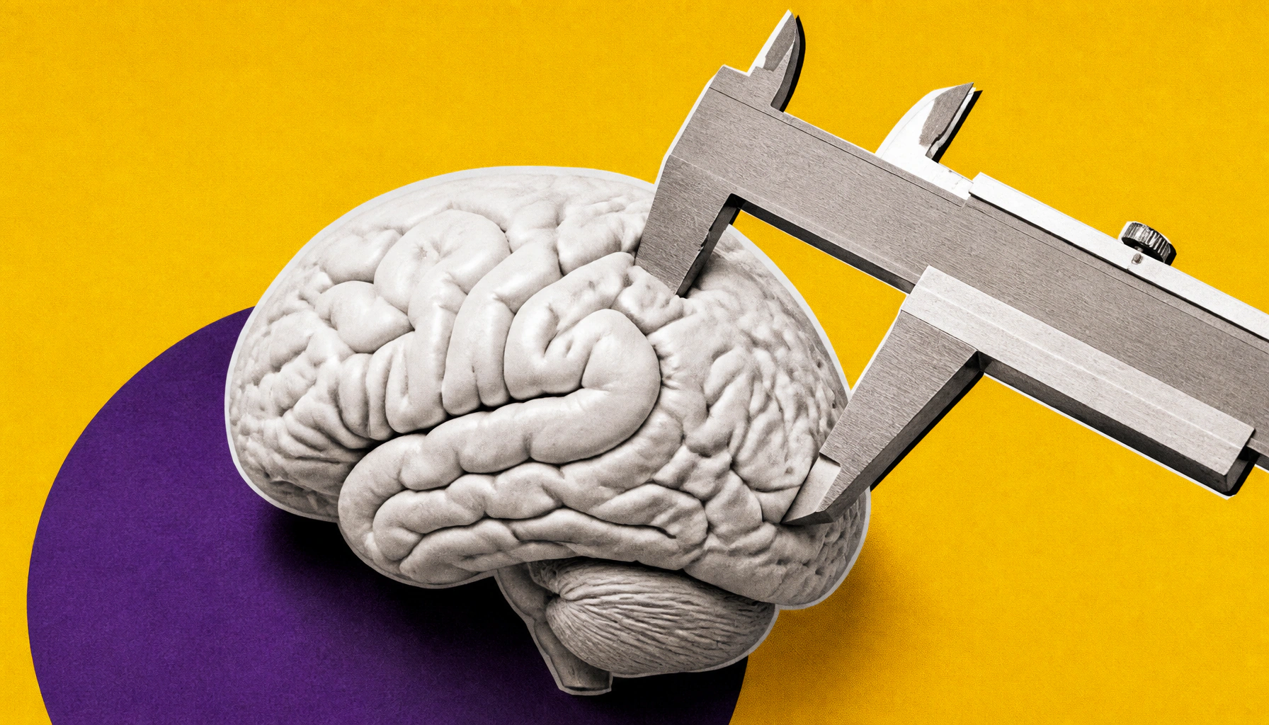 APOE4 gene found to shrink brain cells years before Alzheimer's symptoms — and scientists may have found a way to reverse it