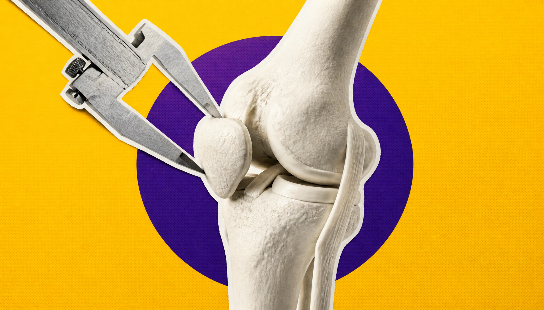 Why "patellofemoral syndrome" isn't a good enough diagnosis