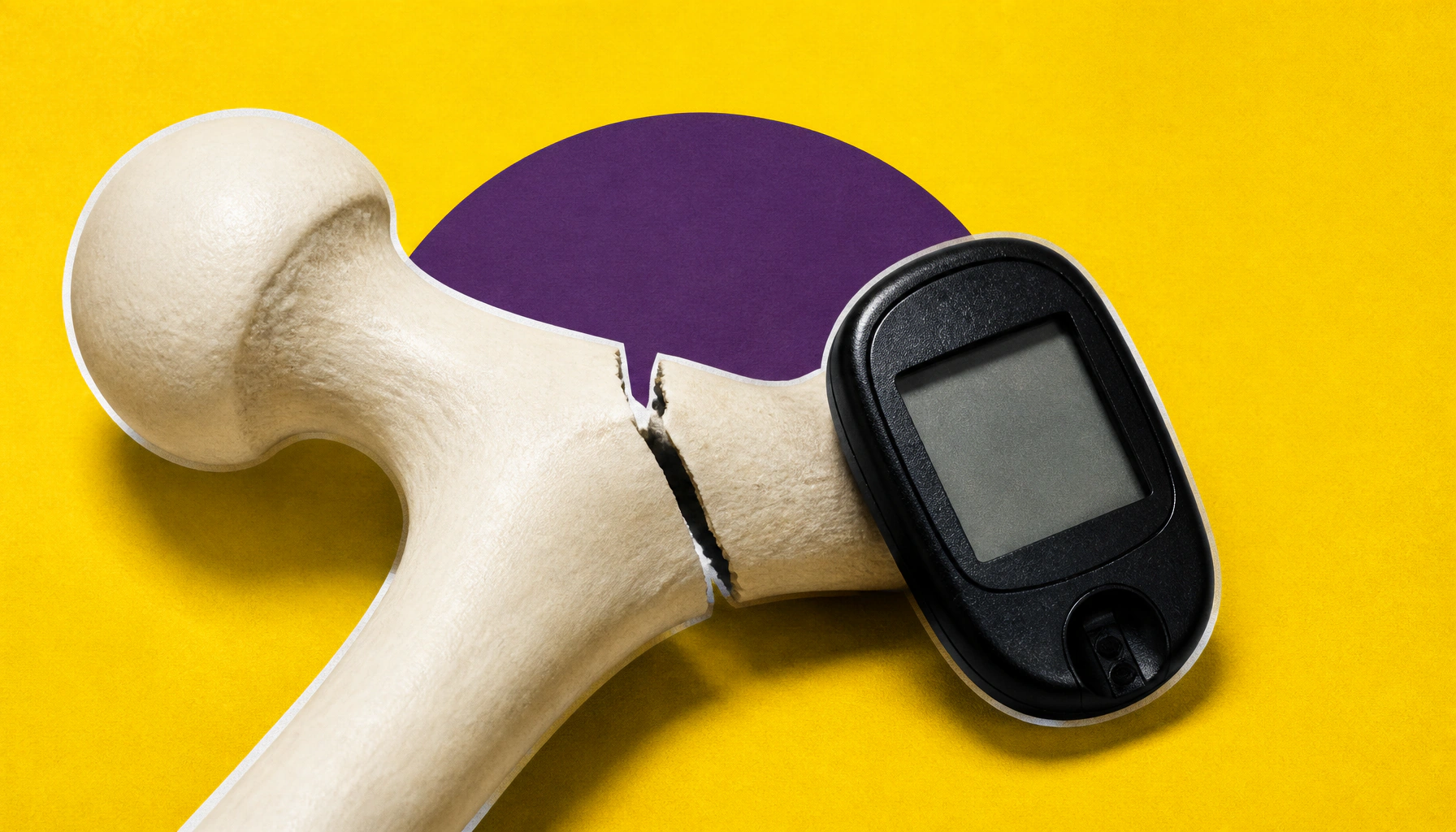 Type 1 diabetes raises fracture risk early — and it only gets worse with kidney disease