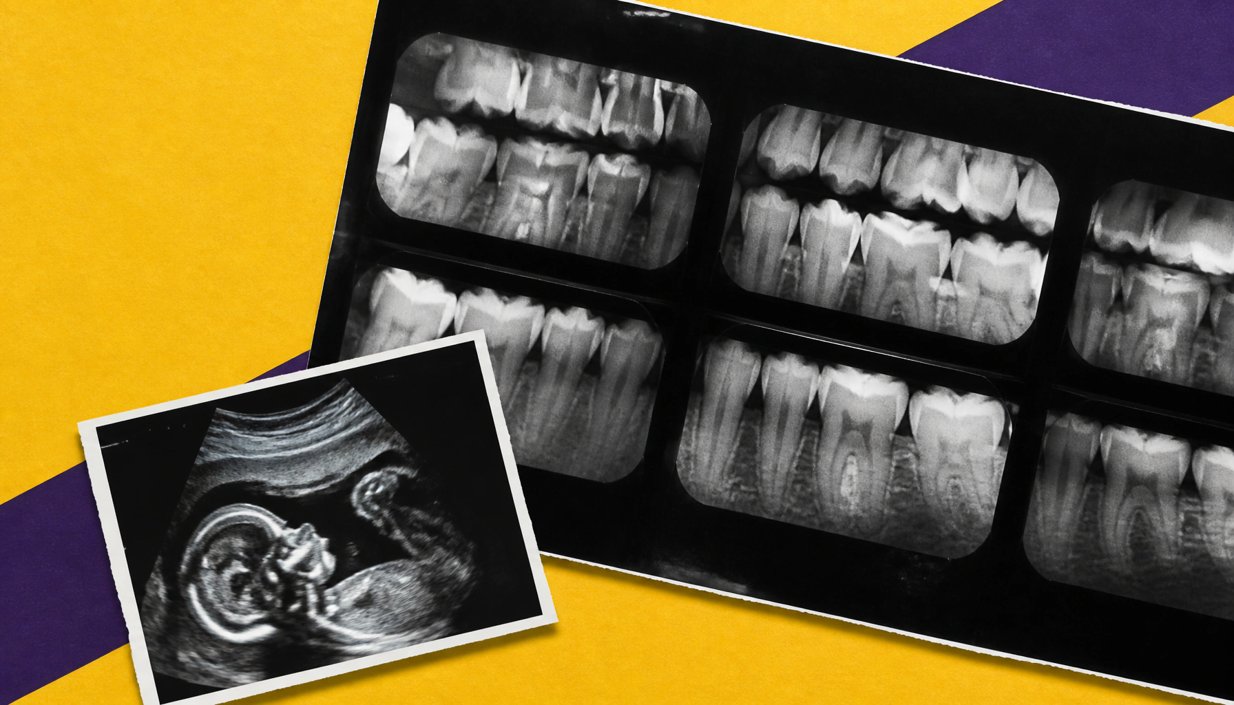 A simple scheduling tweak during prenatal visits dramatically boosts dental care follow-through