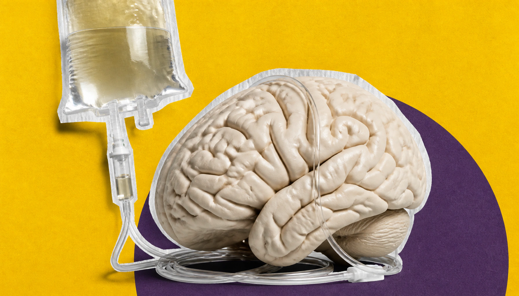 Why rheumatologists need to become students of neuroimmunology