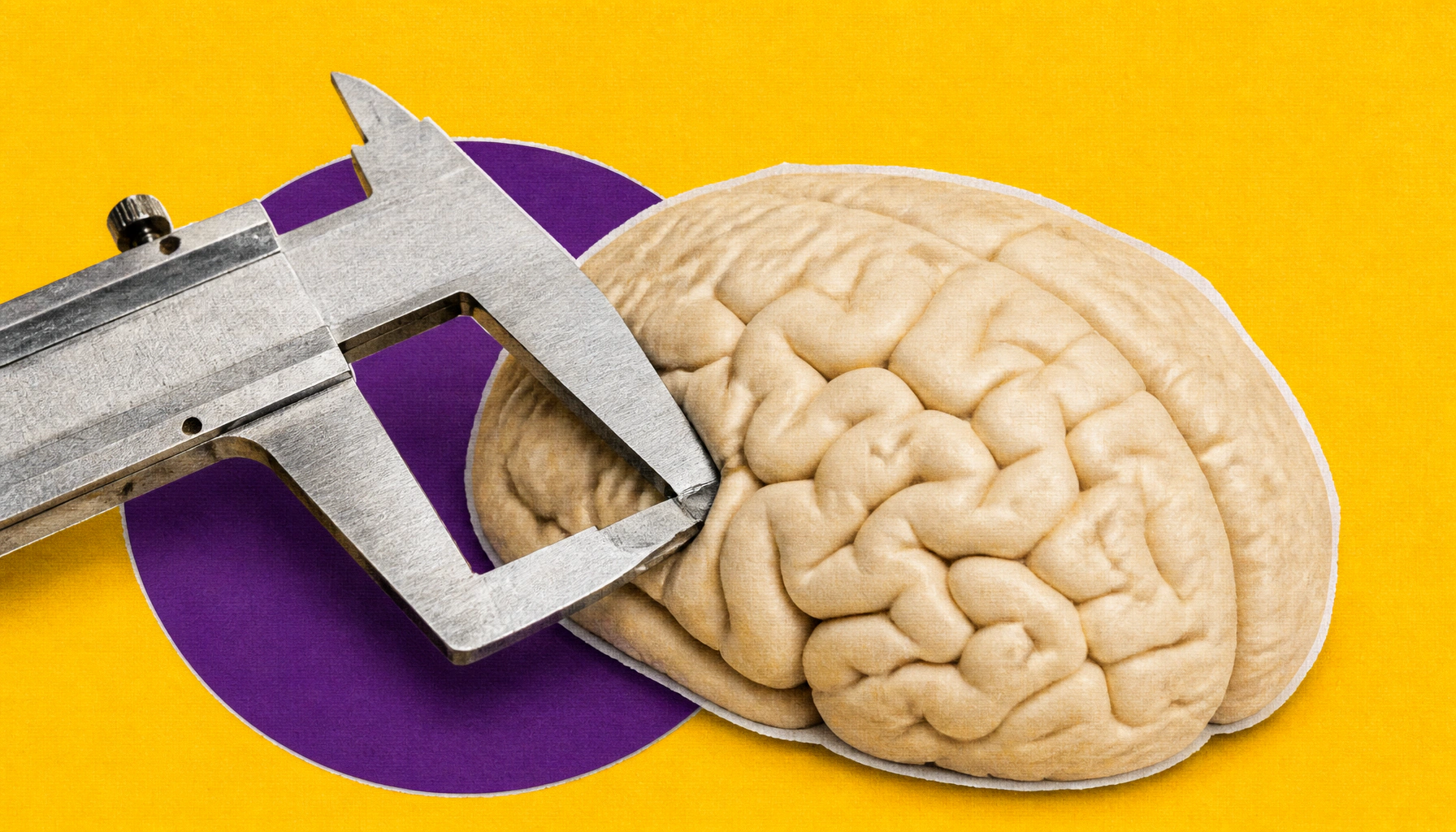 Brain structural changes may signal Alzheimer's years before amyloid plaques appear