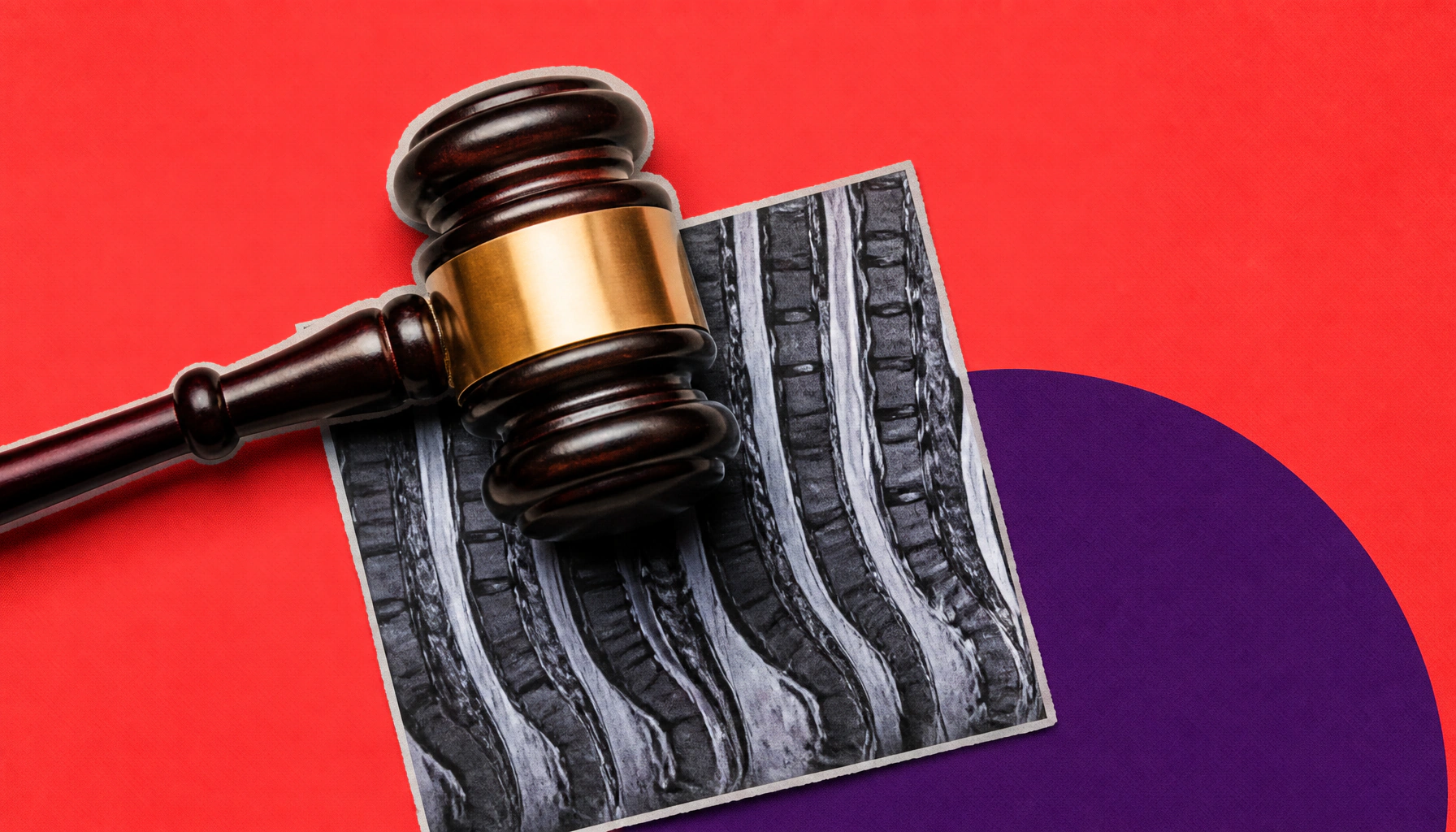 FDA hits pause on RGX-121 gene therapy for Hunter syndrome after spinal MRI red flags