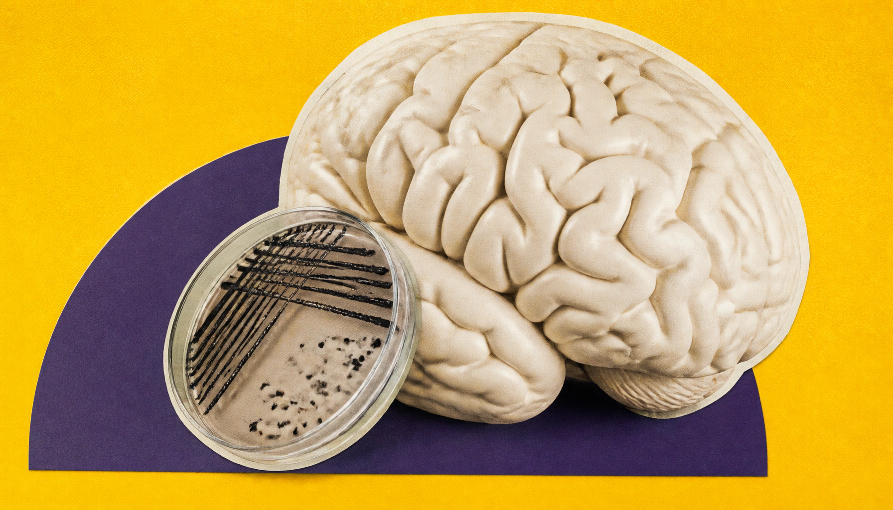 Gut bug, brain risk: H. pylori infection linked to higher odds of Parkinson's disease