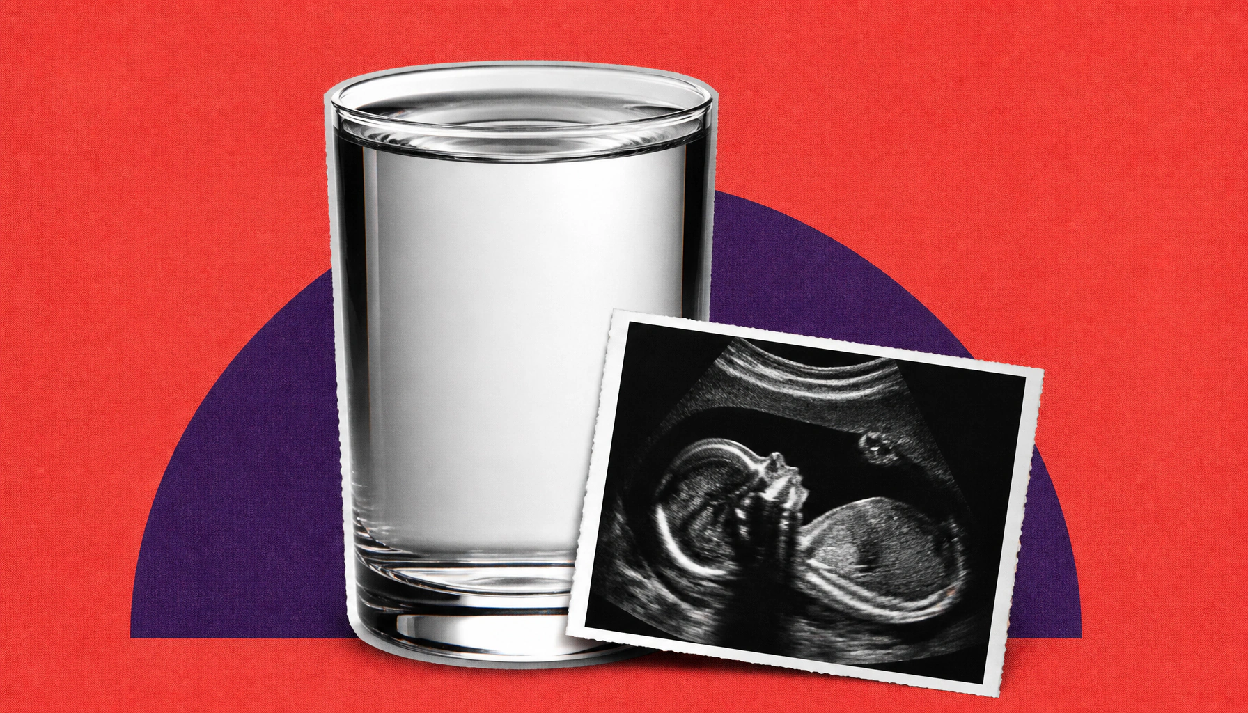 Prenatal fluoride exposure linked to lower cognitive scores in children, new study finds
