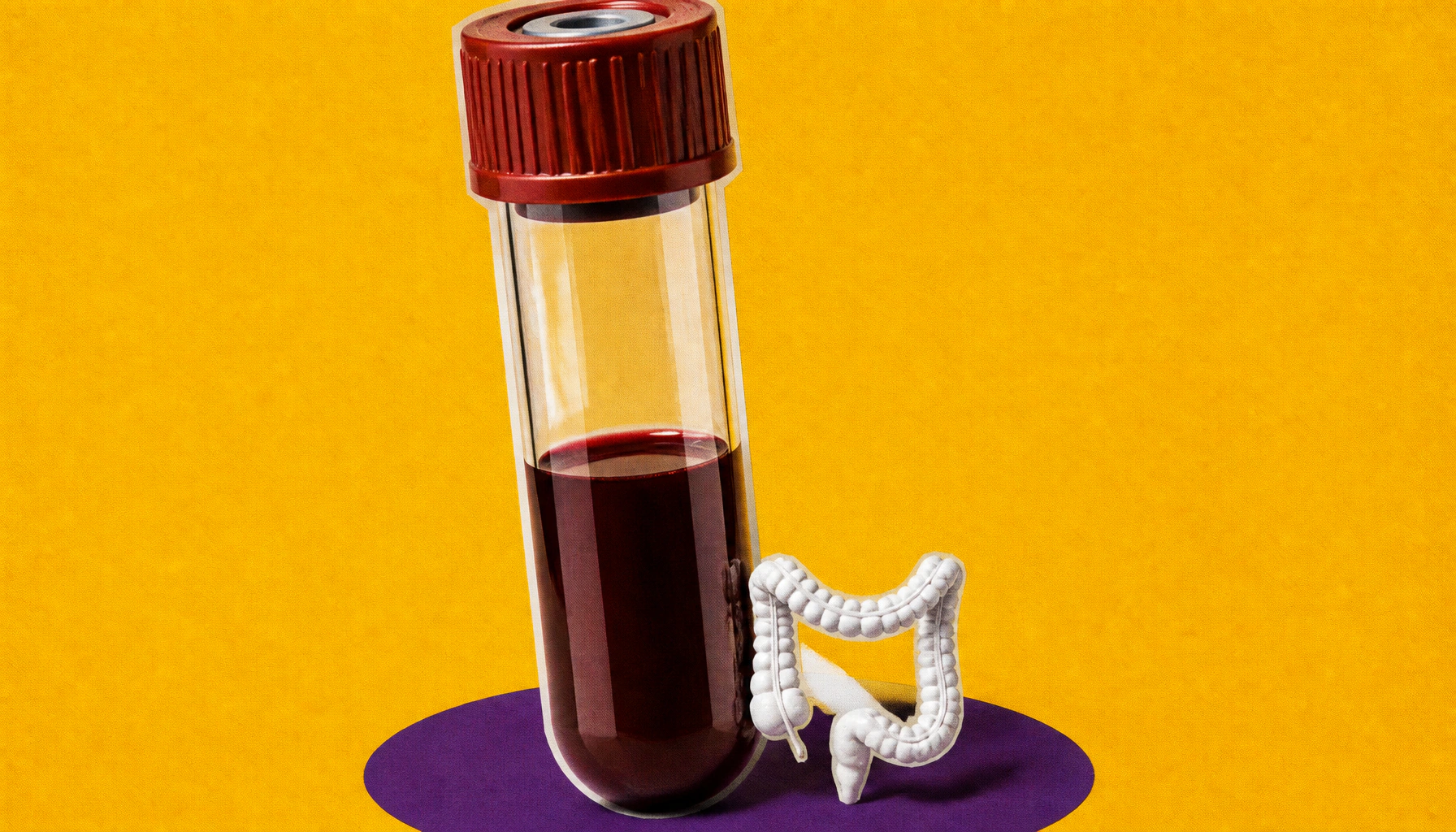 Your immune system signals IBD up to a decade before symptoms appear
