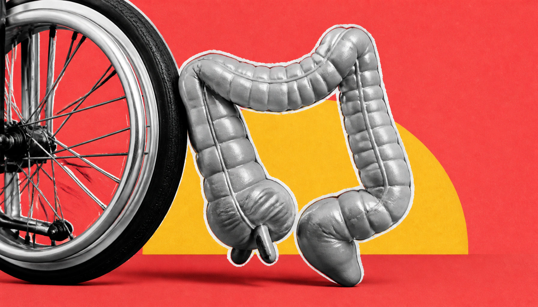 Bowel urgency in ulcerative colitis is more common — and more disabling — than you might think