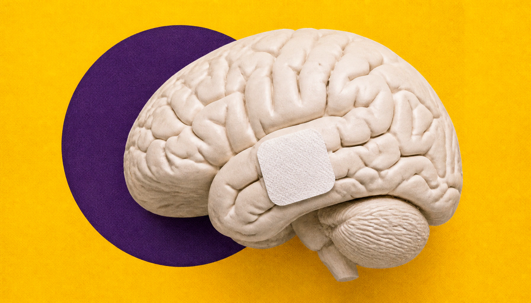 Hormone replacement therapy linked to lower dementia risk in postmenopausal women