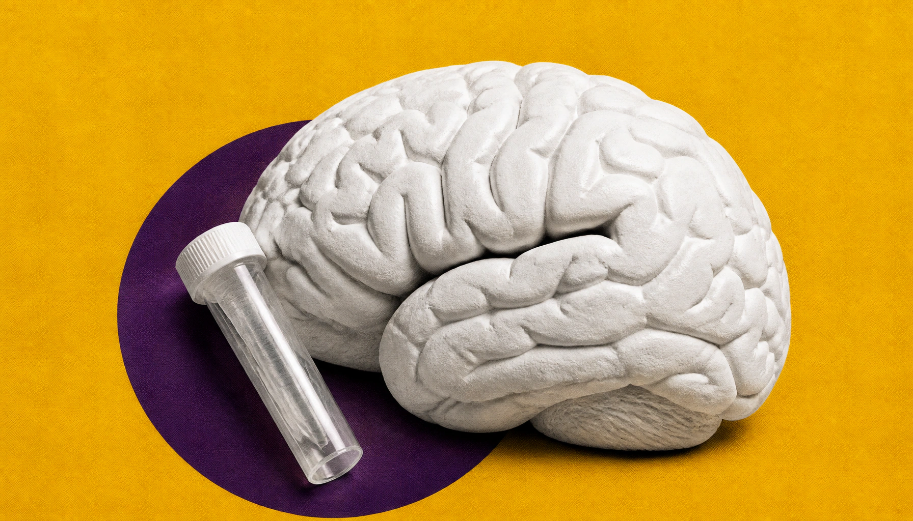 New multi-ancestry genetic score could transform Alzheimer's risk prediction for diverse populations