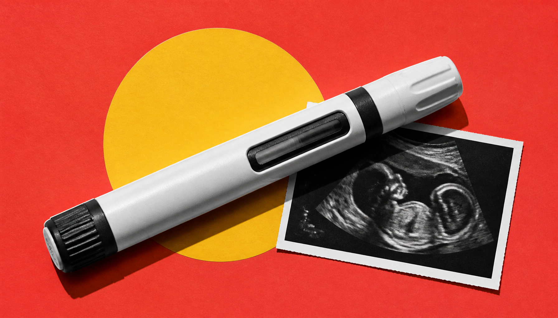 Semaglutide before or during pregnancy linked to higher risk of complications