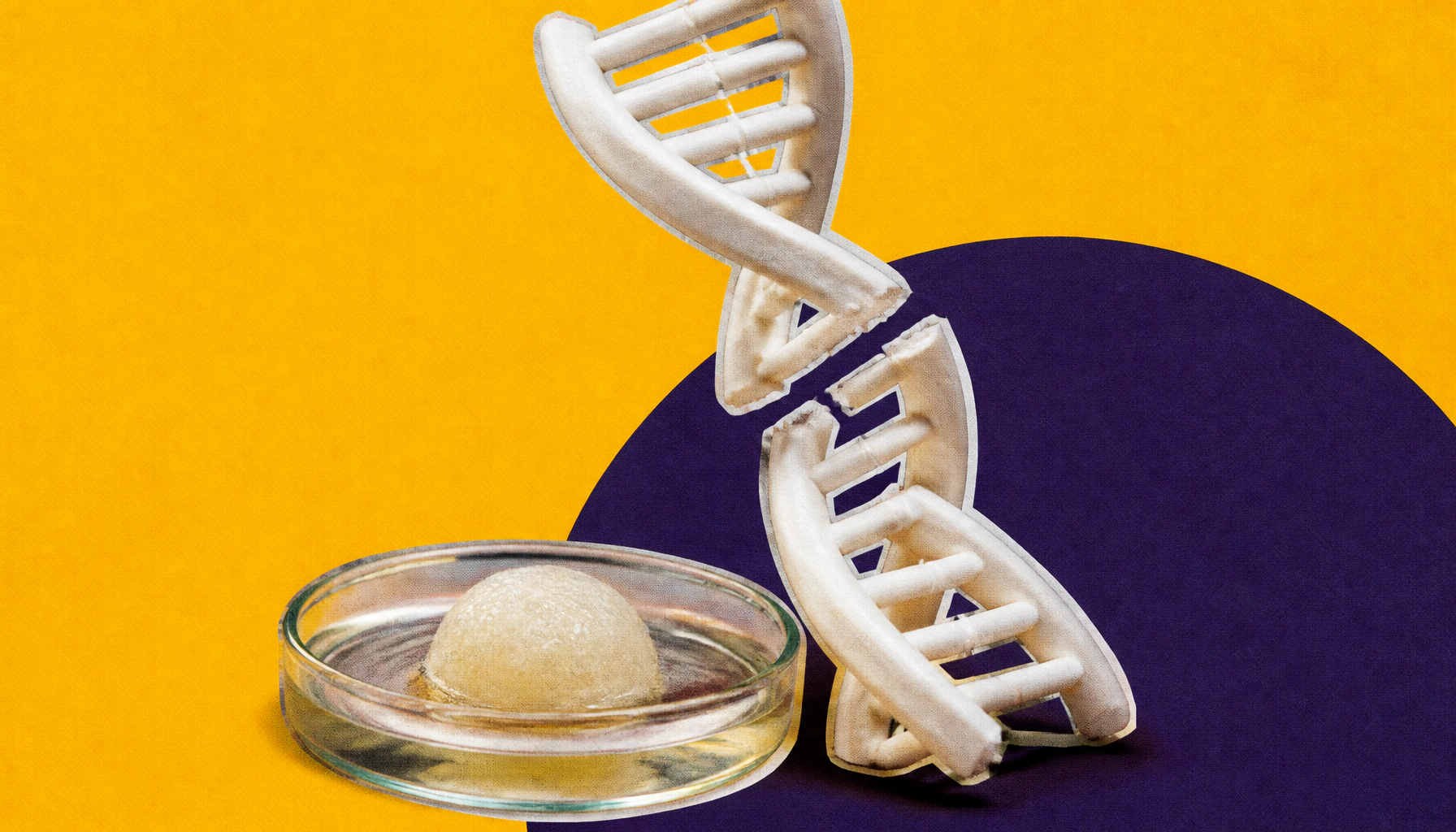 A human-specific DNA quirk may be quietly driving dementia