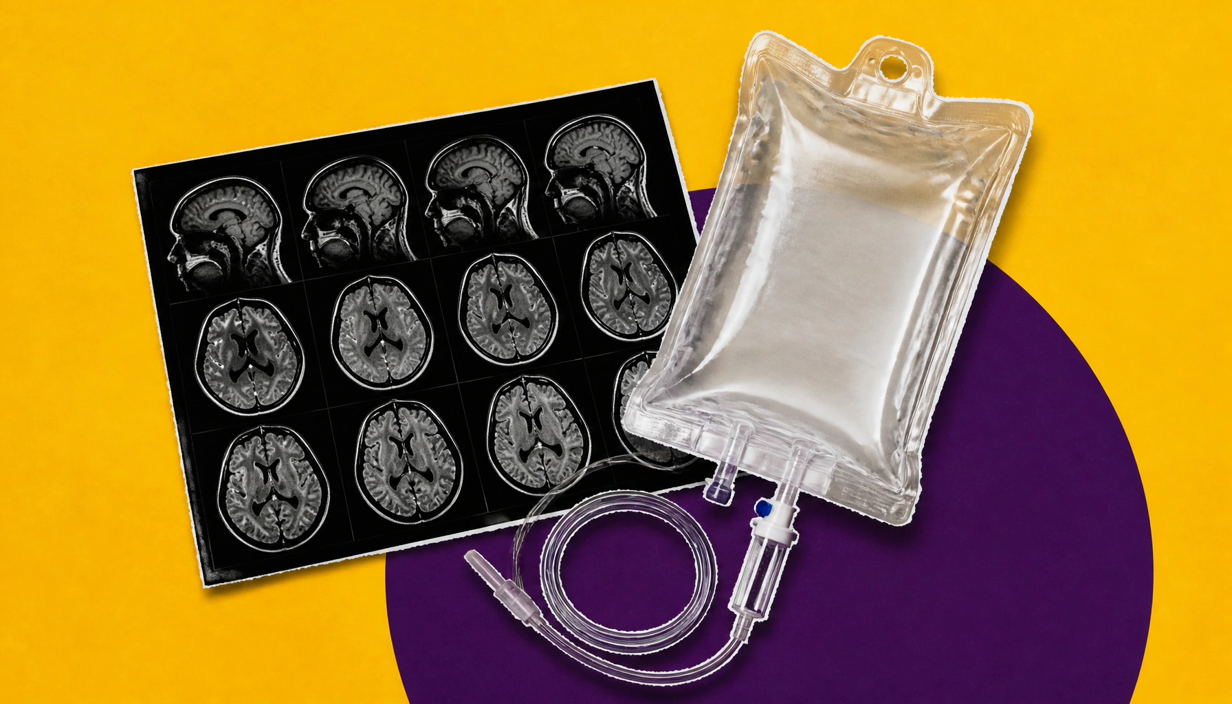 MS diagnosis and treatment are getting a major upgrade — here's what clinicians need to know