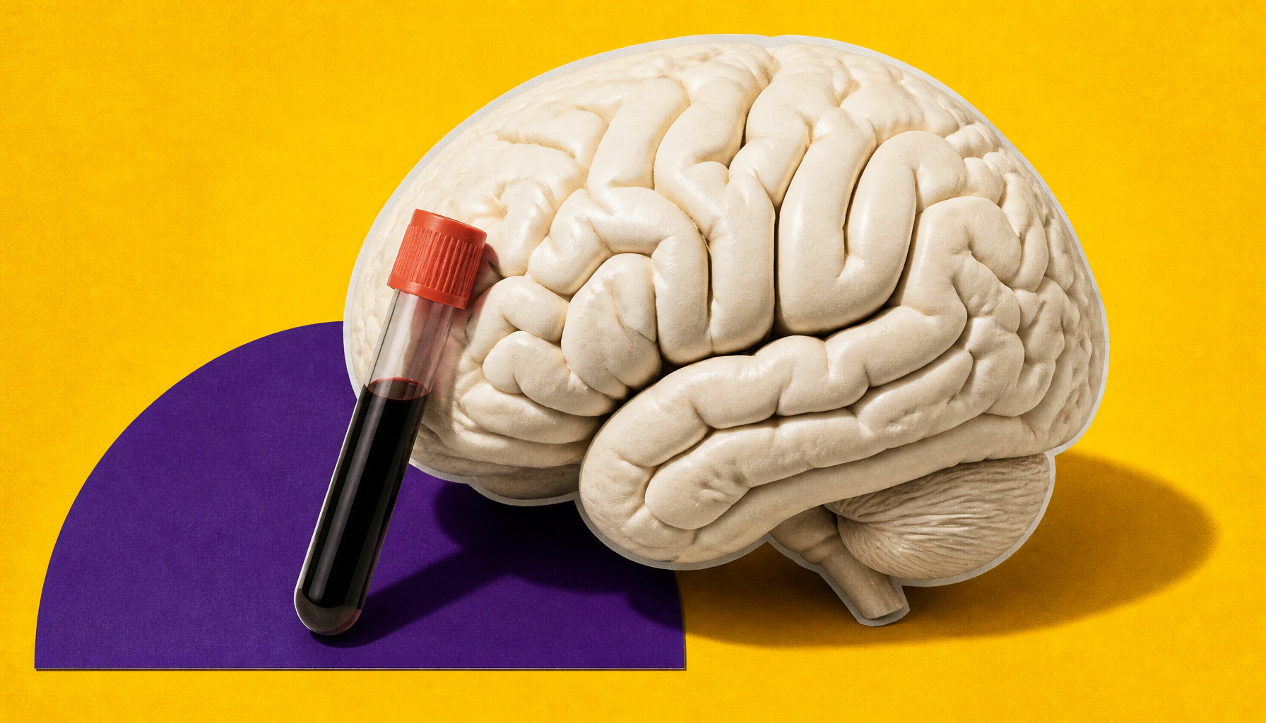 AI-powered platform pinpoints new Alzheimer's targets — and they show up in blood