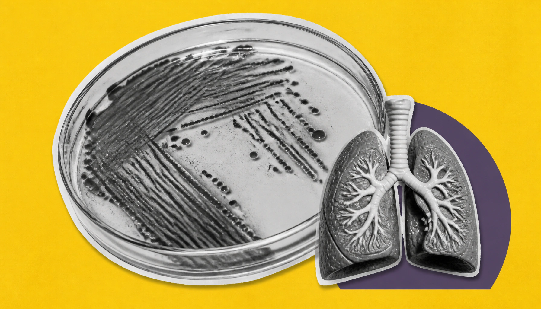 Bacterial protein fragment corisin identified as a key driver of pulmonary fibrosis — and a promising treatment target