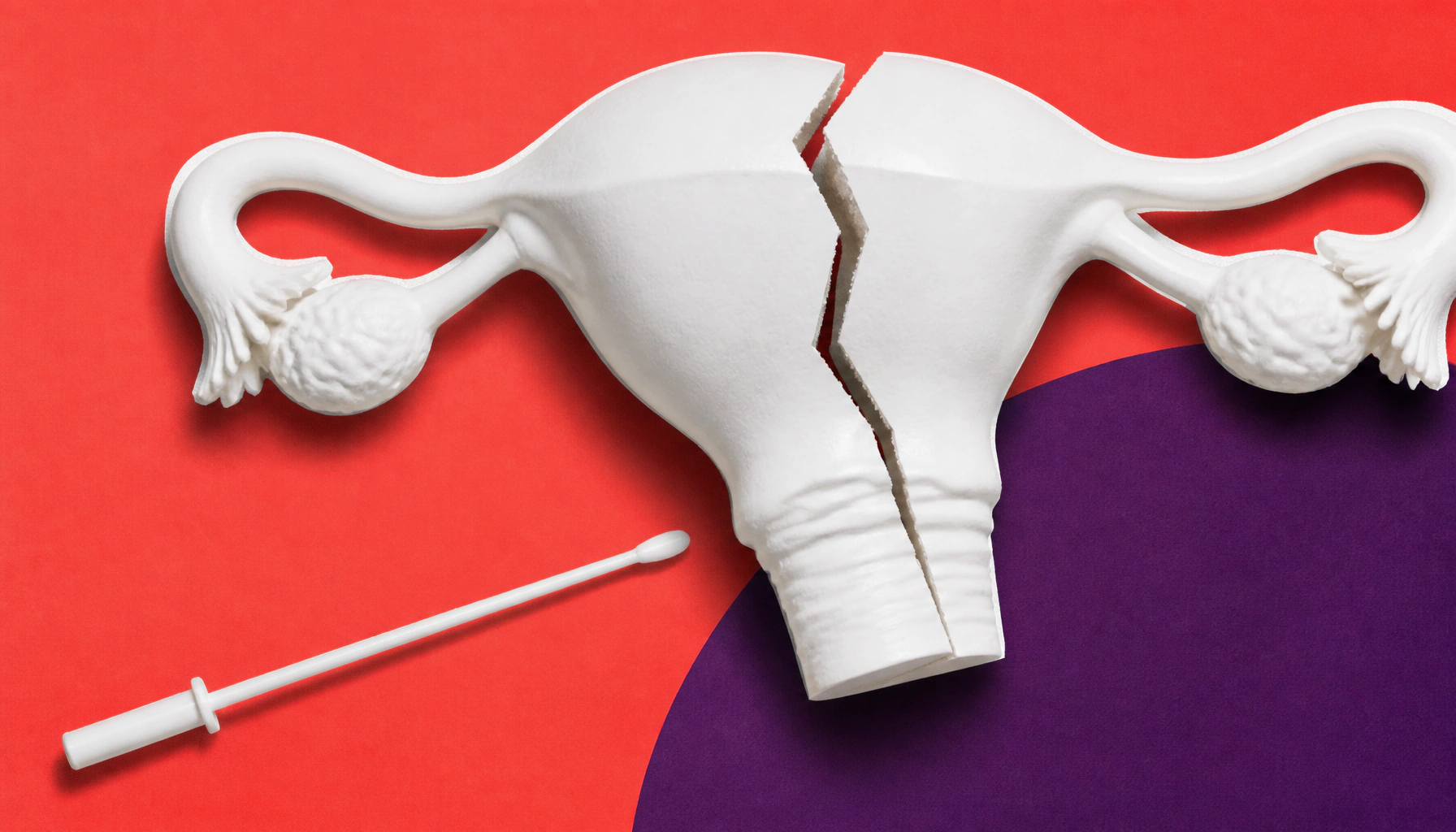 Young Black women face dramatically worse endometrial cancer survival odds