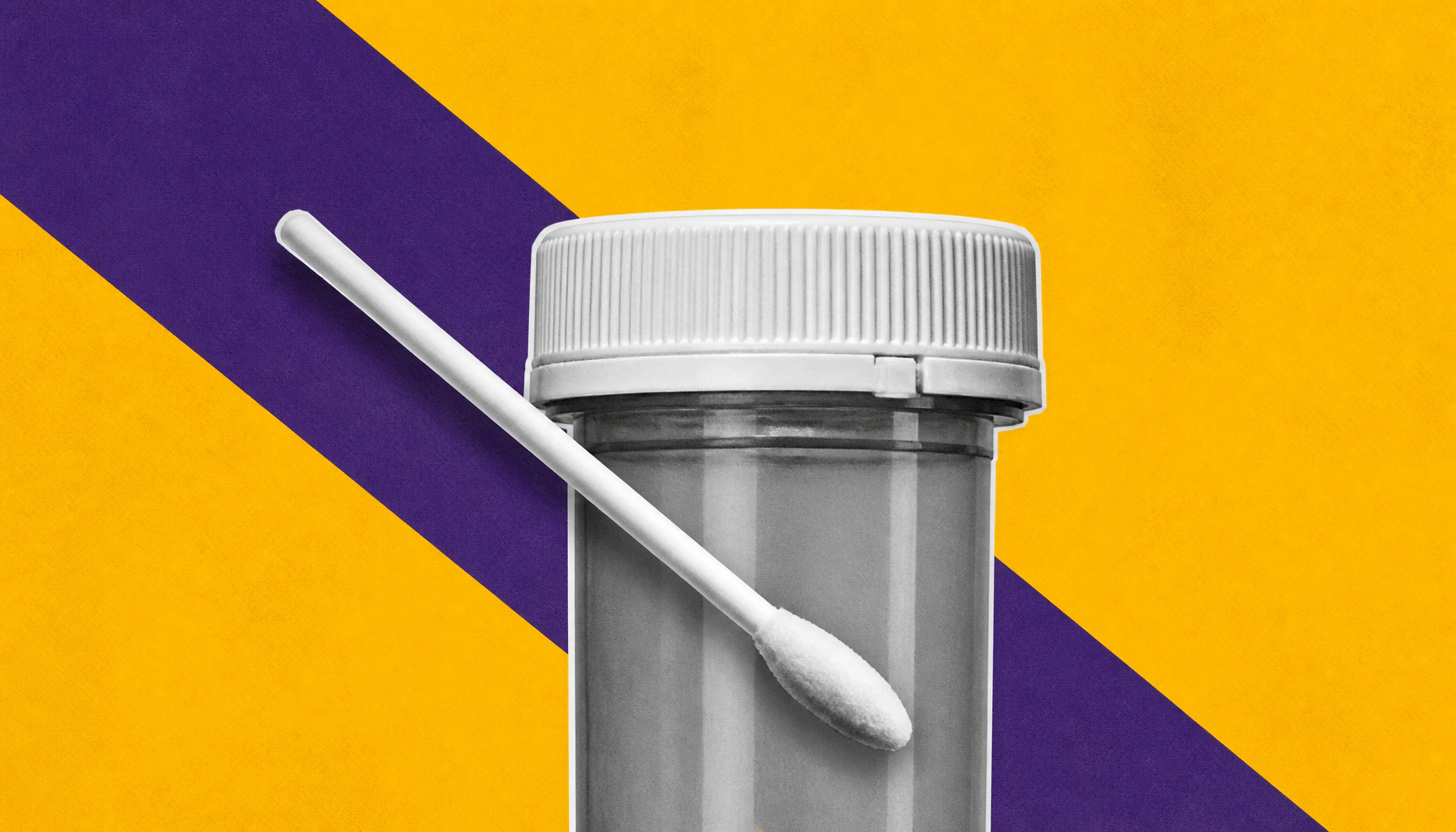 Millions prescribed lamotrigine may be getting the wrong genetic safety test