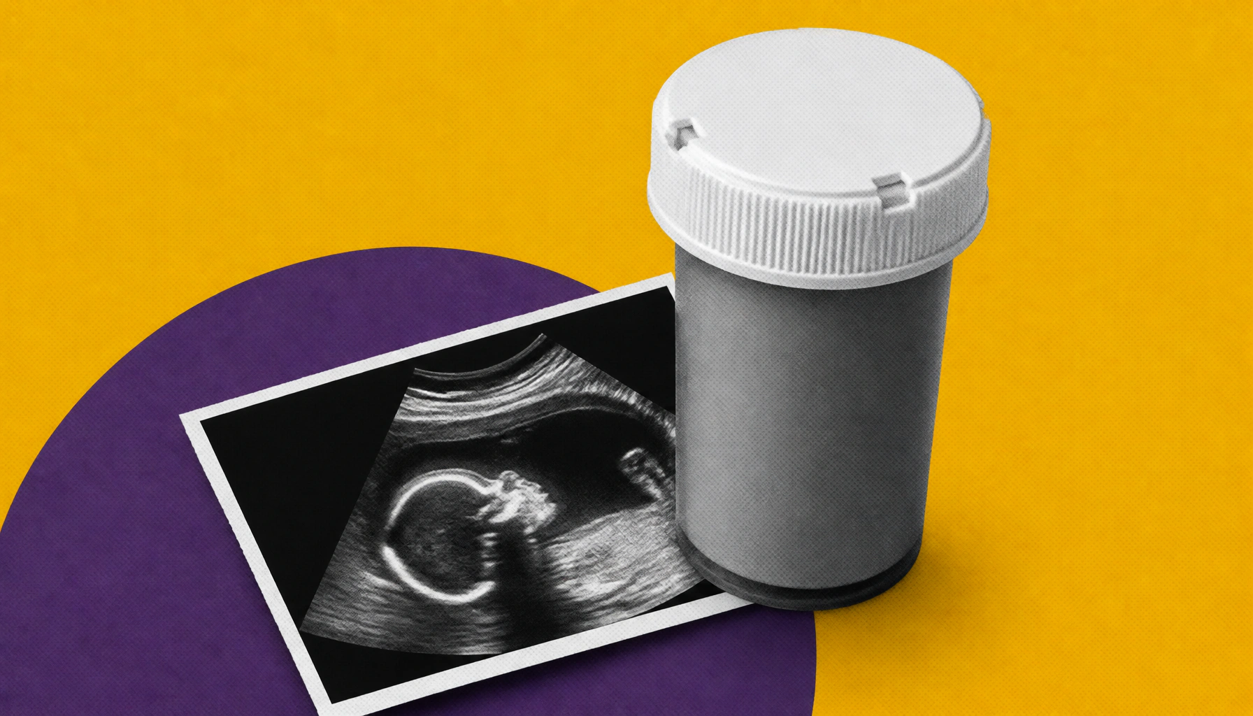 Staying on antidepressants during pregnancy cuts postpartum depression risk