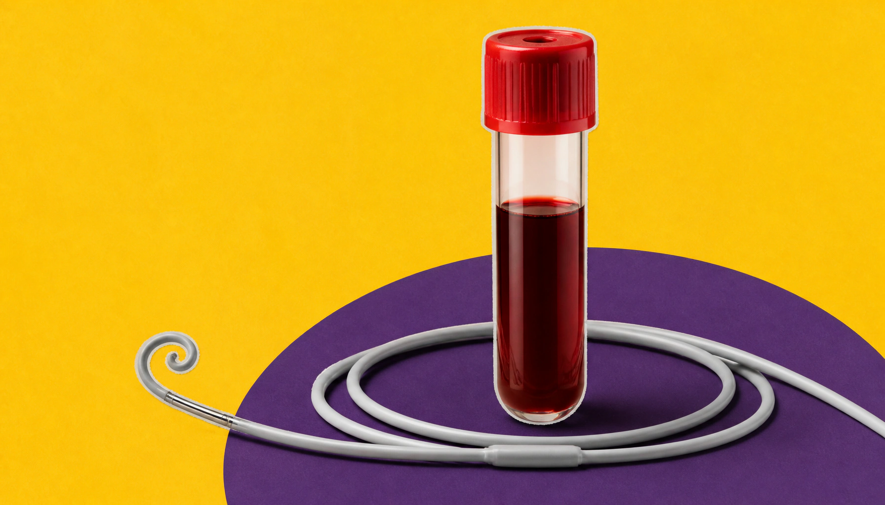 New blood-based score tells "broken heart syndrome" apart from a heart attack
