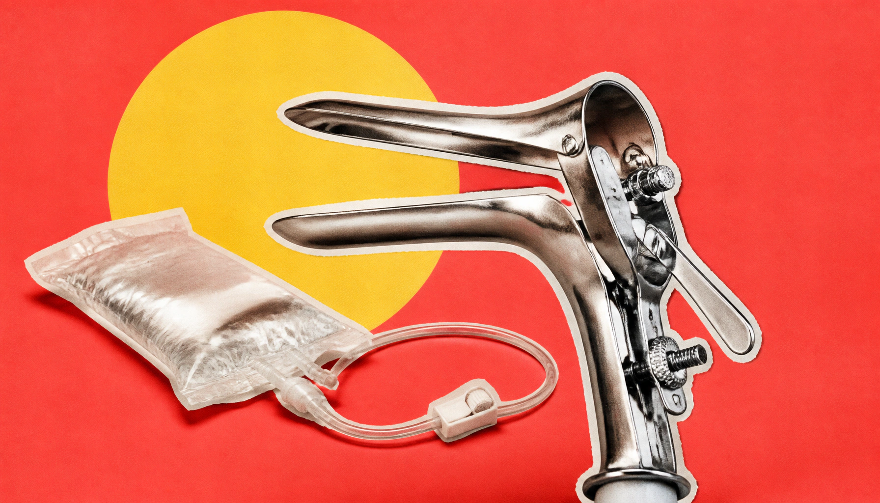 Cervical cancer screening rates are falling — and it's showing up in cancer diagnoses