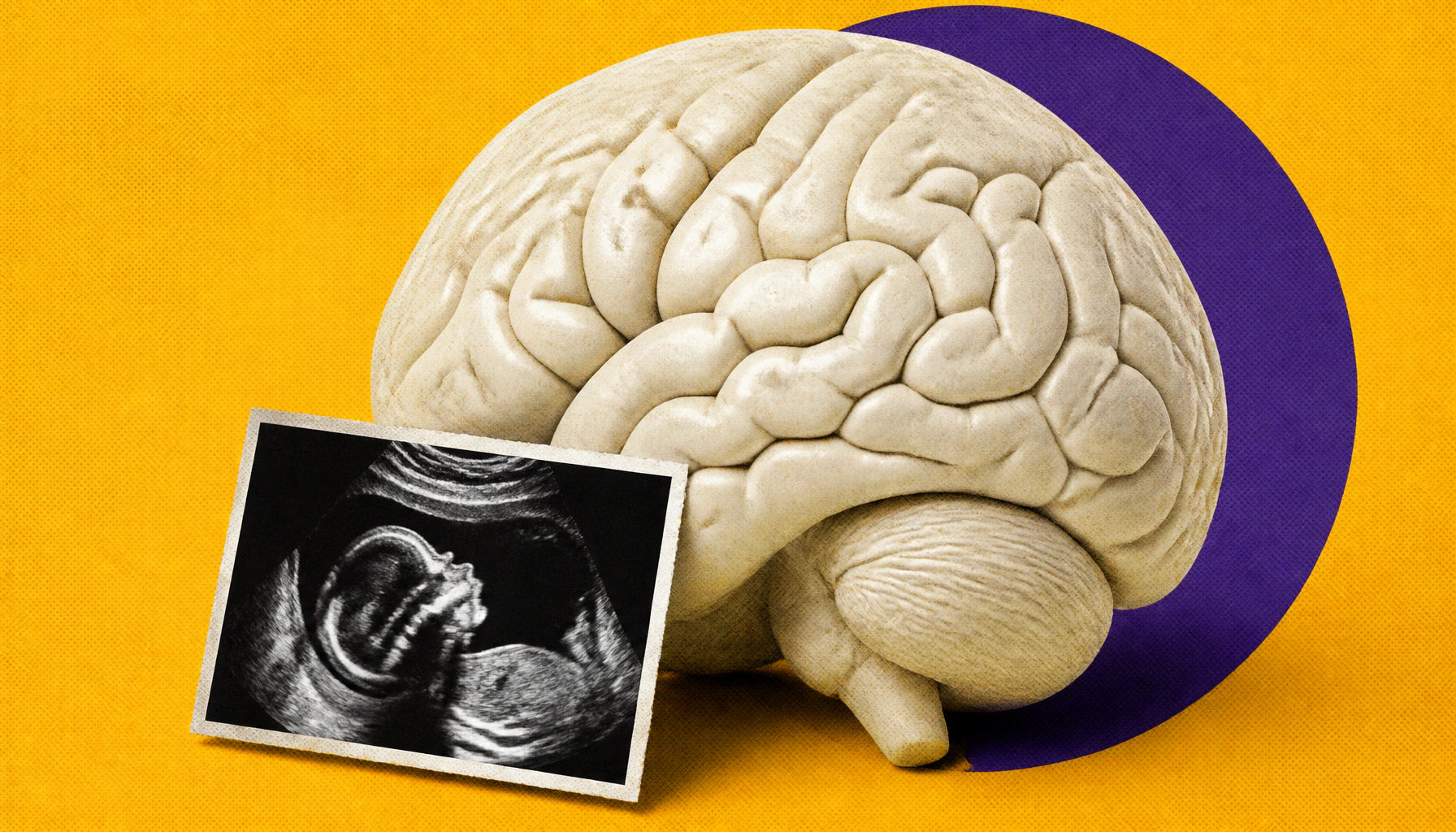 Sick during pregnancy? Your immune response may leave lasting marks on your baby's brain