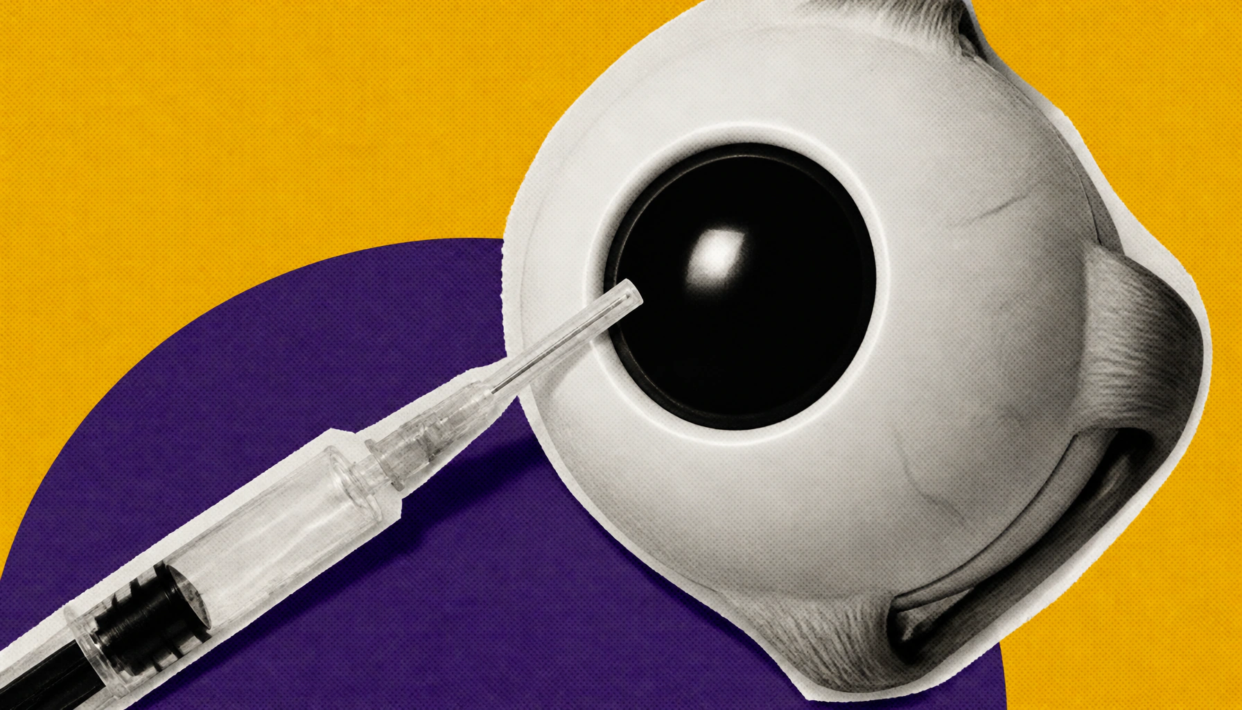 Vabysmo delivers lasting vision gains in hard-to-treat eye condition common in Asia