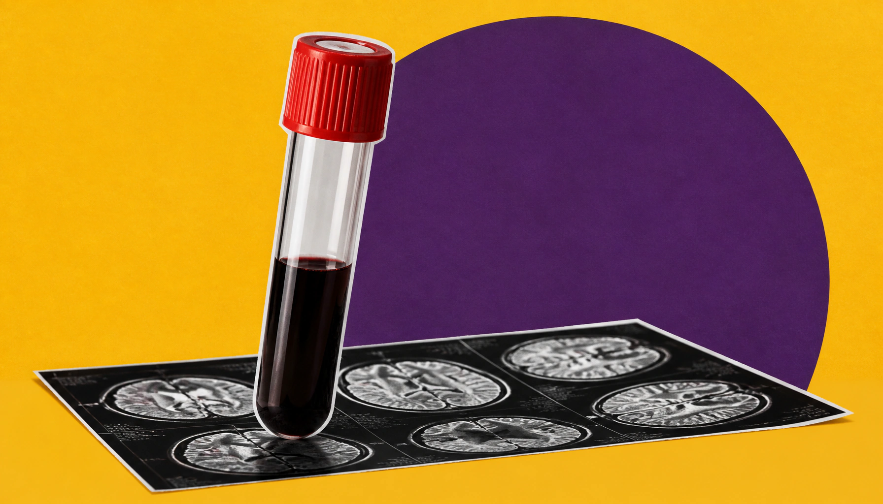Prostate cancer screening: Who needs it, when, and why it can't wait